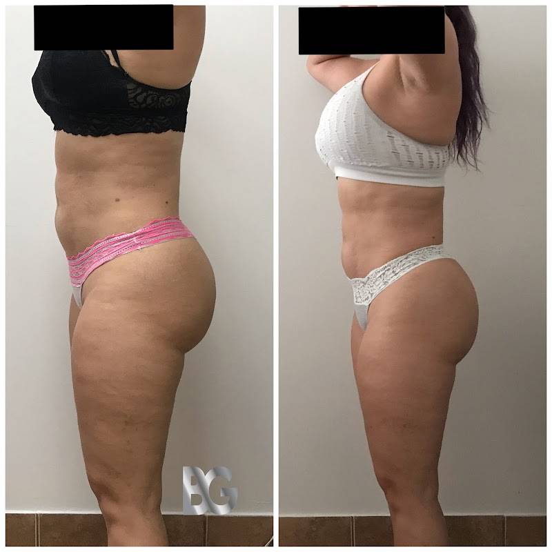 Be Glam Studio | Med Spa