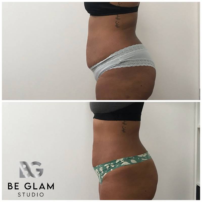 Be Glam Studio | Med Spa